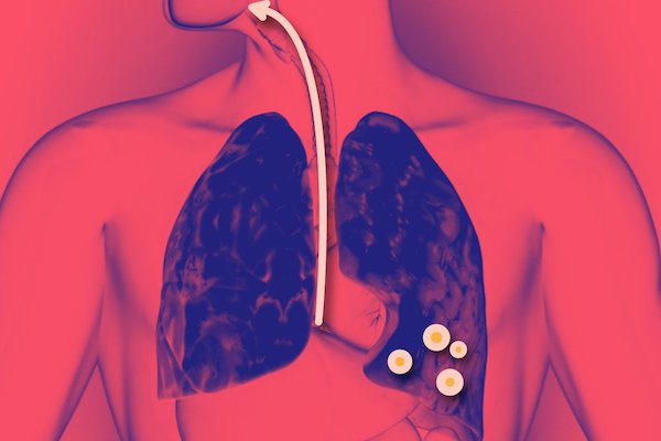 EPOC. Foto: Especial