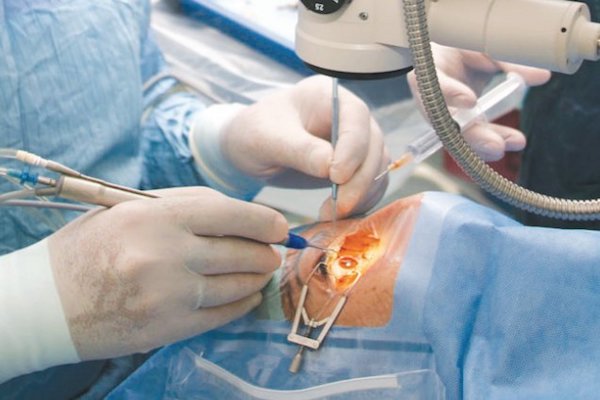 Operación. Foto: Especial