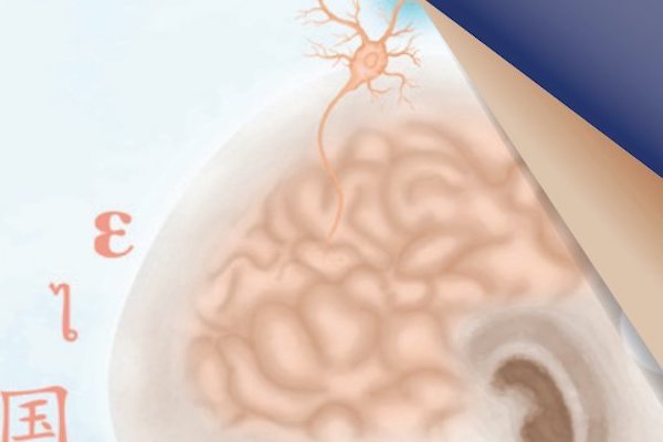 Cerebro. Foto: Especial