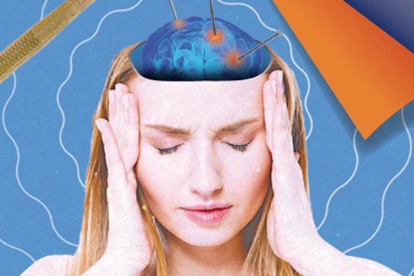 Migraña. Foto: Especial