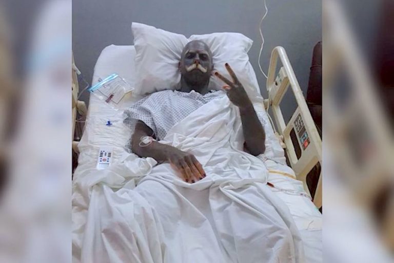 Foto: Instagram @adam.curlykale