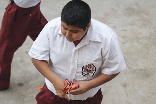 Sobrepeso. Foto: Cuartoscuro