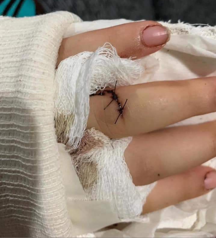 En muy malas condiciones jovencta tras ataque de su ex novio.