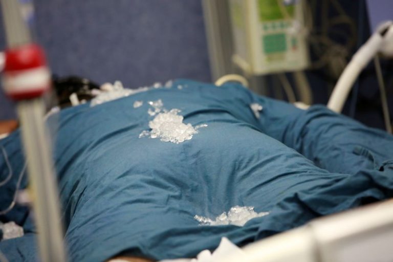 LYNXMPEGA201P.jpg,Foto de arhivo. Un paciente que padece la enfermedad del coronavirus (COVID-19) está siendo tratado con hielo para controlar su temperatura en una unidad de cuidados intensivos en el Hospital Juárez en la Ciudad de México, 29 de octubre 2020. REUTERS/Carlos Jasso; Crédito: CARLOS JASSO, Reuters